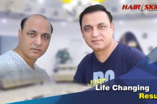 Hair Transplant Center in Pakistan